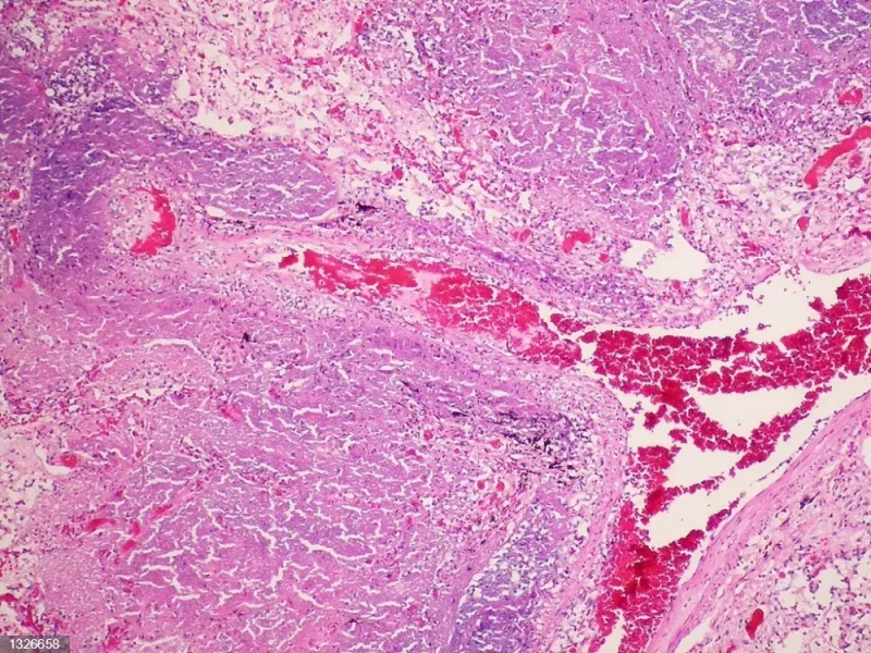 Muestra de tejido bajo microscopio